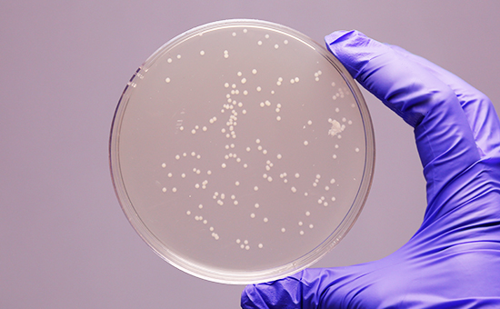 Escherichia coli