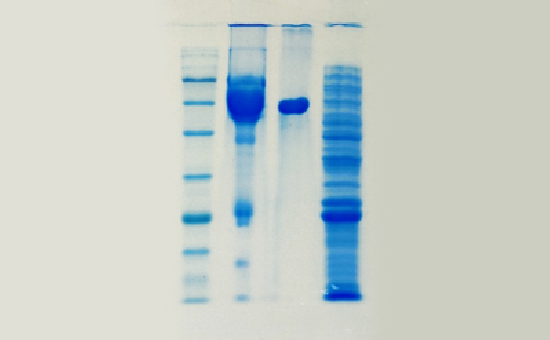 HiPer® Protein Assay Teaching Kits