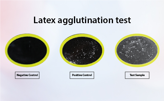 Latex Agglutination Test Kits