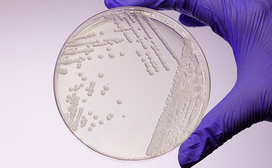 Saccharomyces cerevisiae and Schizosaccharomyces Pombe