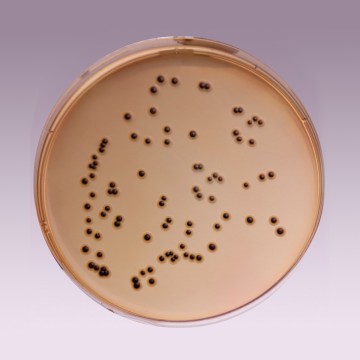 SS Agar, Granulated (Salmonella  Shigella Agar, Granulated)