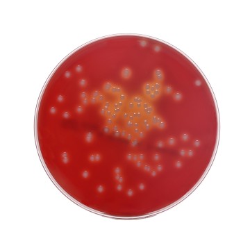 Sheep Blood Agar Plate
