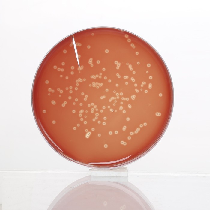 HiEncap™ Blood Agar Base (HiEncap™ Infusion Agar)