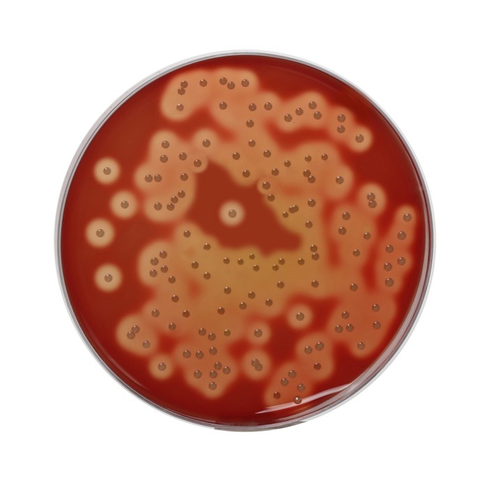 HiEncap™ Blood Agar Base (HiEncap™ Infusion Agar)