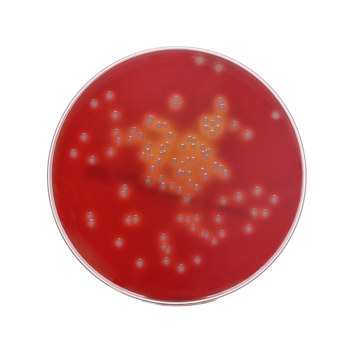 Sheep Blood Agar Plate