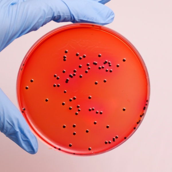 Xylose Lysine Deoxycholate Agar (XLD Agar)