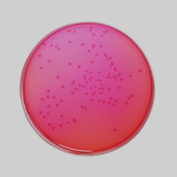 Xylose Lysine Deoxycholate Agar (XLD Agar)