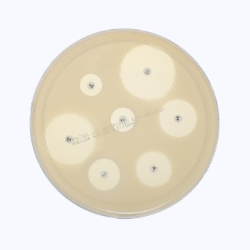Mueller Hinton Agar Plate 
(150mm plate)