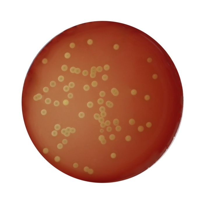 Columbia Blood Agar Base