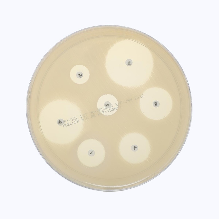Mueller Hinton Agar Plate 
(150mm plate)